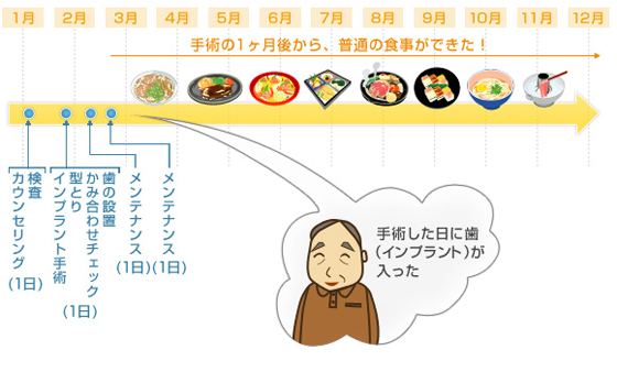 1日インプラント説明図 手術した日に入れ歯が入った